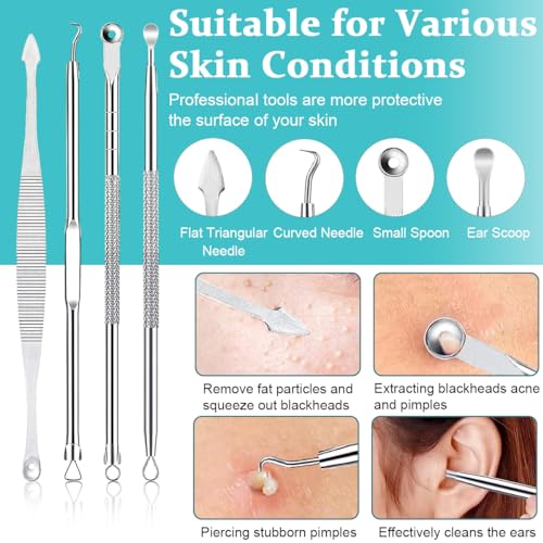 MAYCREATE® Blackhead Remover Tool Kit Pore Cleaning Tools, 15pcs Stainless Steel Blackhead Remover Tool Kit for Pimples, Blackheads, Whiteheads, Zit, Deep Pore Cleaning Tool with Storage Box MAYCREATE® Blackhead Remover Tool Kit Pore Cleaning Tools, 15pcs Stainless Steel Blackhead Remover Tool Kit for Pimples, Blackheads, Whiteheads, Zit, Deep Pore Cleaning Tool with Storage Box